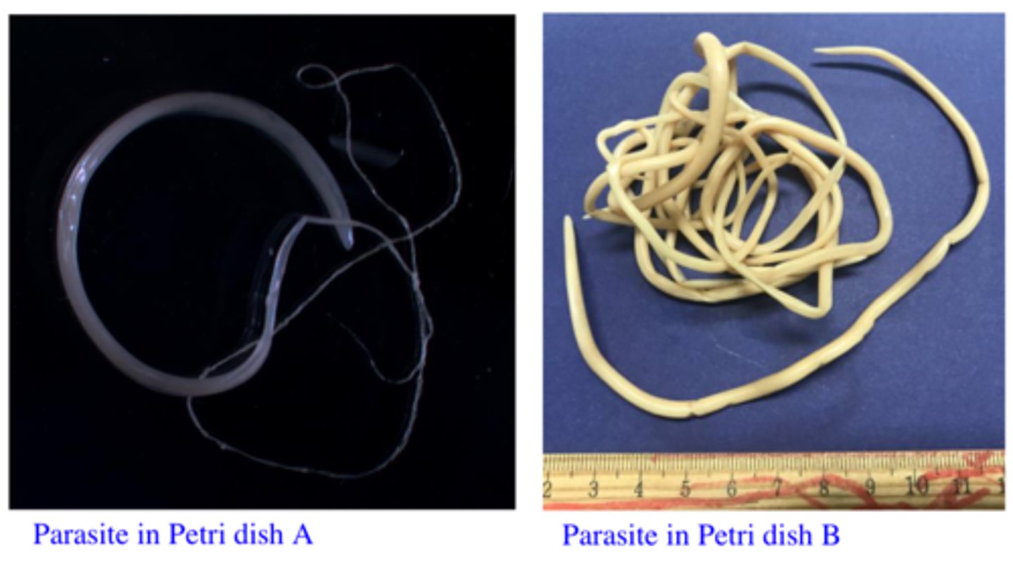<p>Station 13:</p><p>Q3: Select from the parasites in Petri dishes A and B the one that is likely to shed eggs like this and say where it locates in the body of the host.</p>