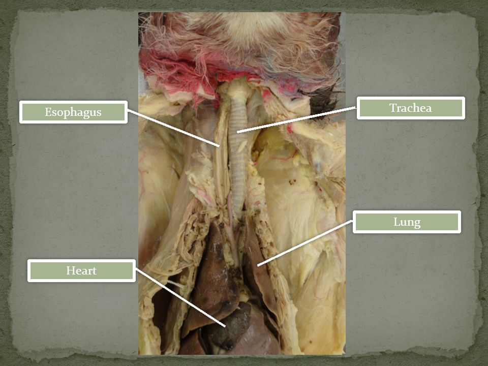 <p>Esophagus</p>