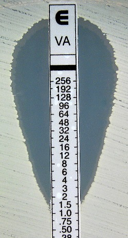 <p><span>The E-test pictured below is depicts a Staphylococcus aureus isolate tested against vancomycin. &nbsp;What is the interpreted vancomycin MIC for this organism?</span></p>