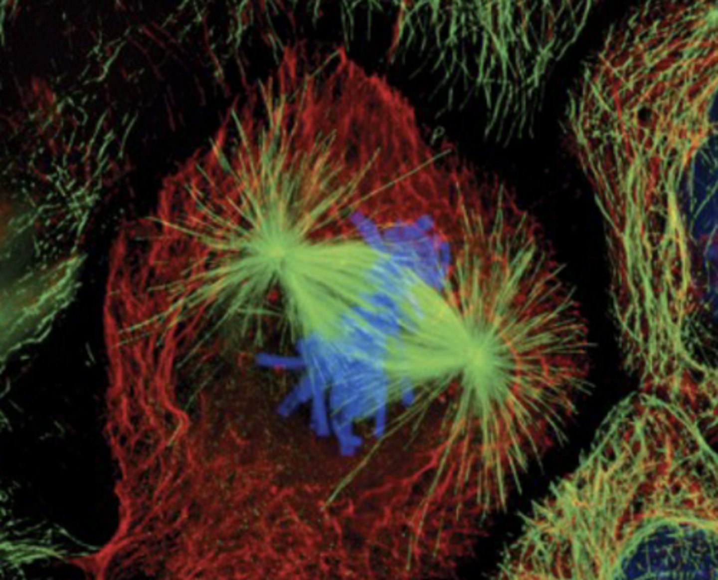 <p>normal cell in mitotic metaphase:</p><p>- chromosomes line up</p><p>- attach to microtubules of spindle (organized by centrosome)</p>