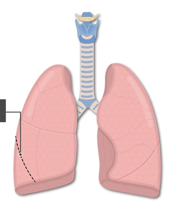 <p>The fissure that separates the superior lobe from the inferior lobe of the right lung is known as the <strong><em></strong></em>__.</p>