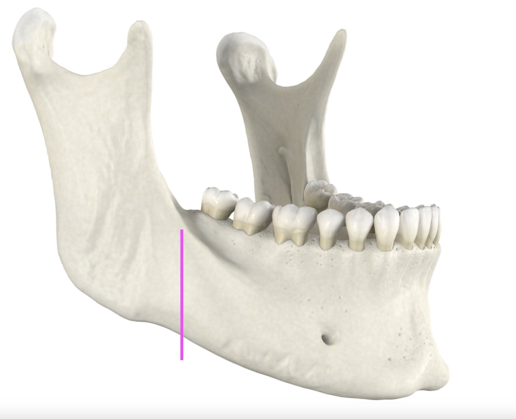 <p>What bone marking is this?</p>