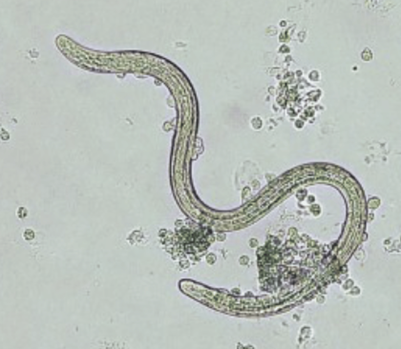 <p>Found in a dog with right sided congestive heart failure. What parasite is this?</p>