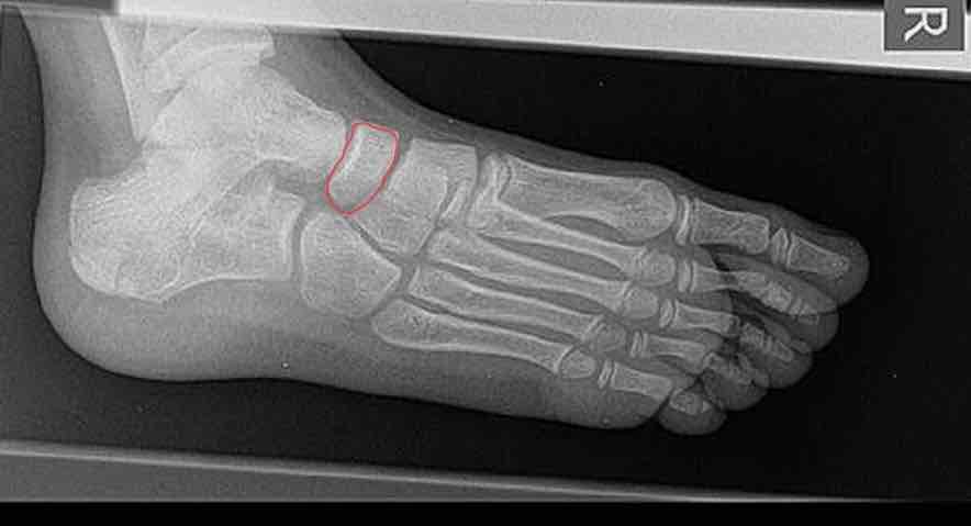 <p>What is this bone?</p>