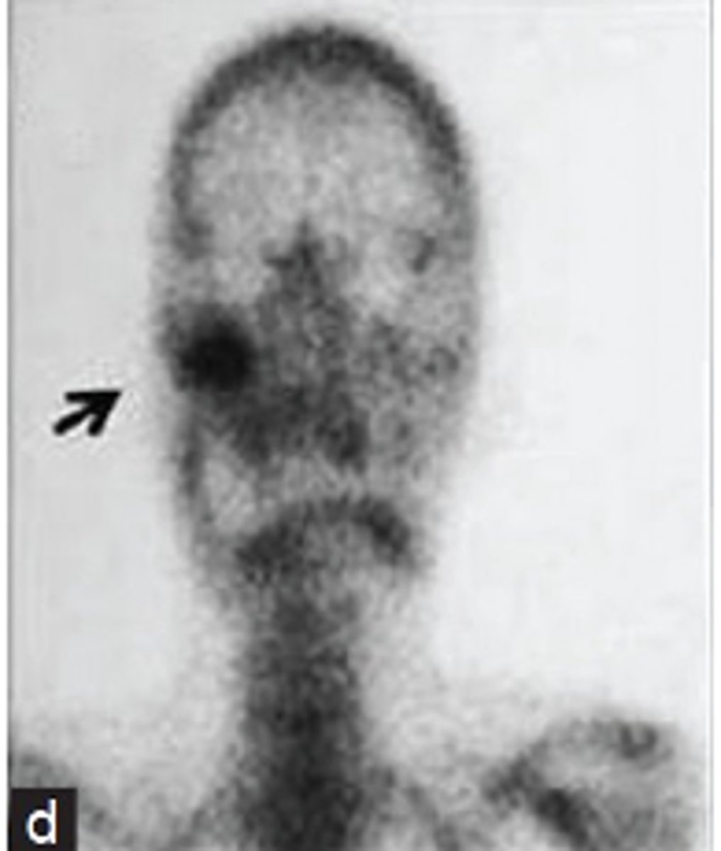 <p>ID the type of Imaging modality:</p><p>- Pano</p><p>- CT</p><p>- CBCT</p><p>- MRI</p><p>- Technetium 99 bone scans</p><p>- PET</p>