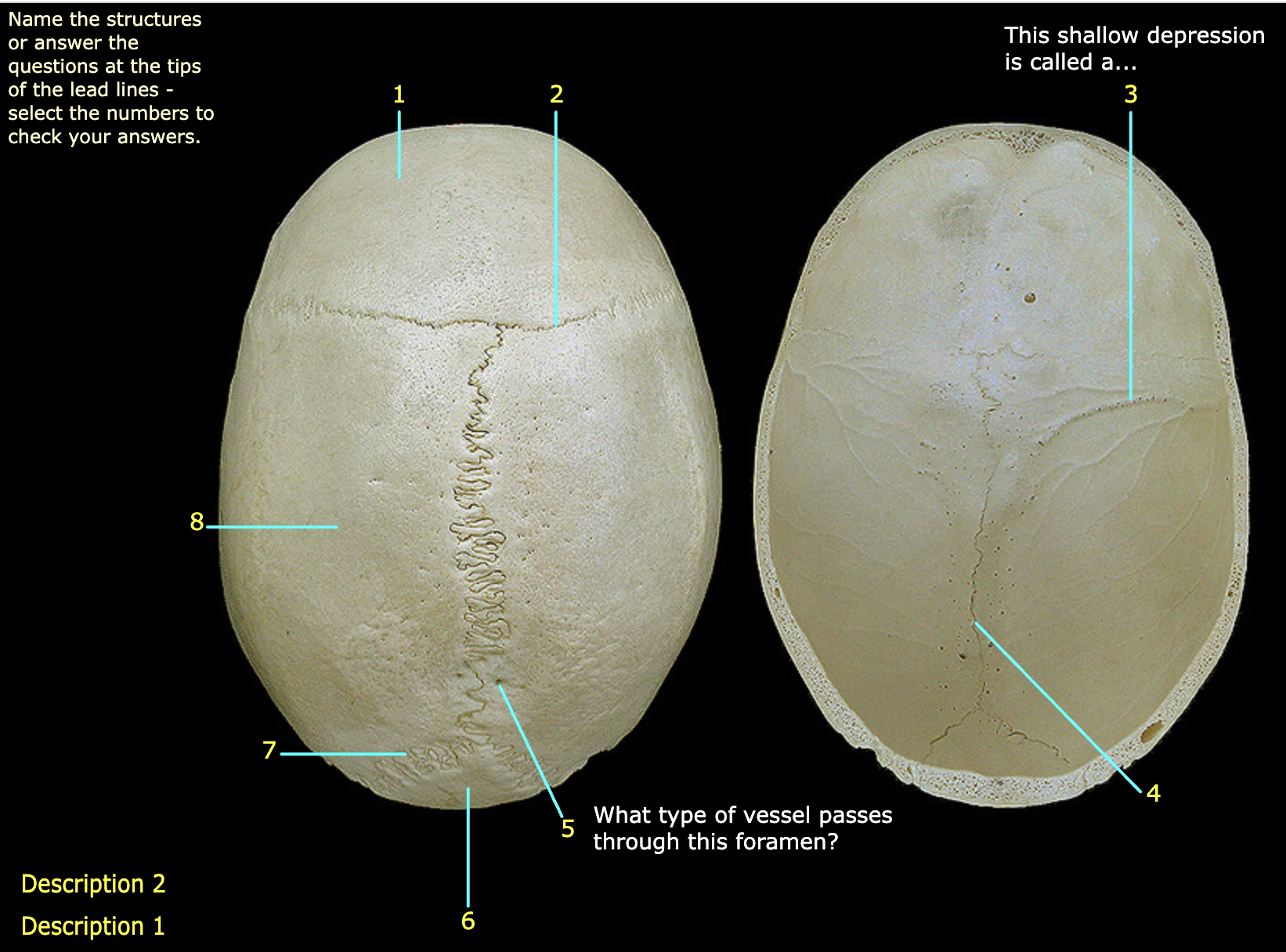 What structure is labeled 4?