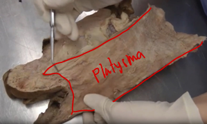<p>draws lips caudally (towards the tail); superficial cutaneous muscle</p>