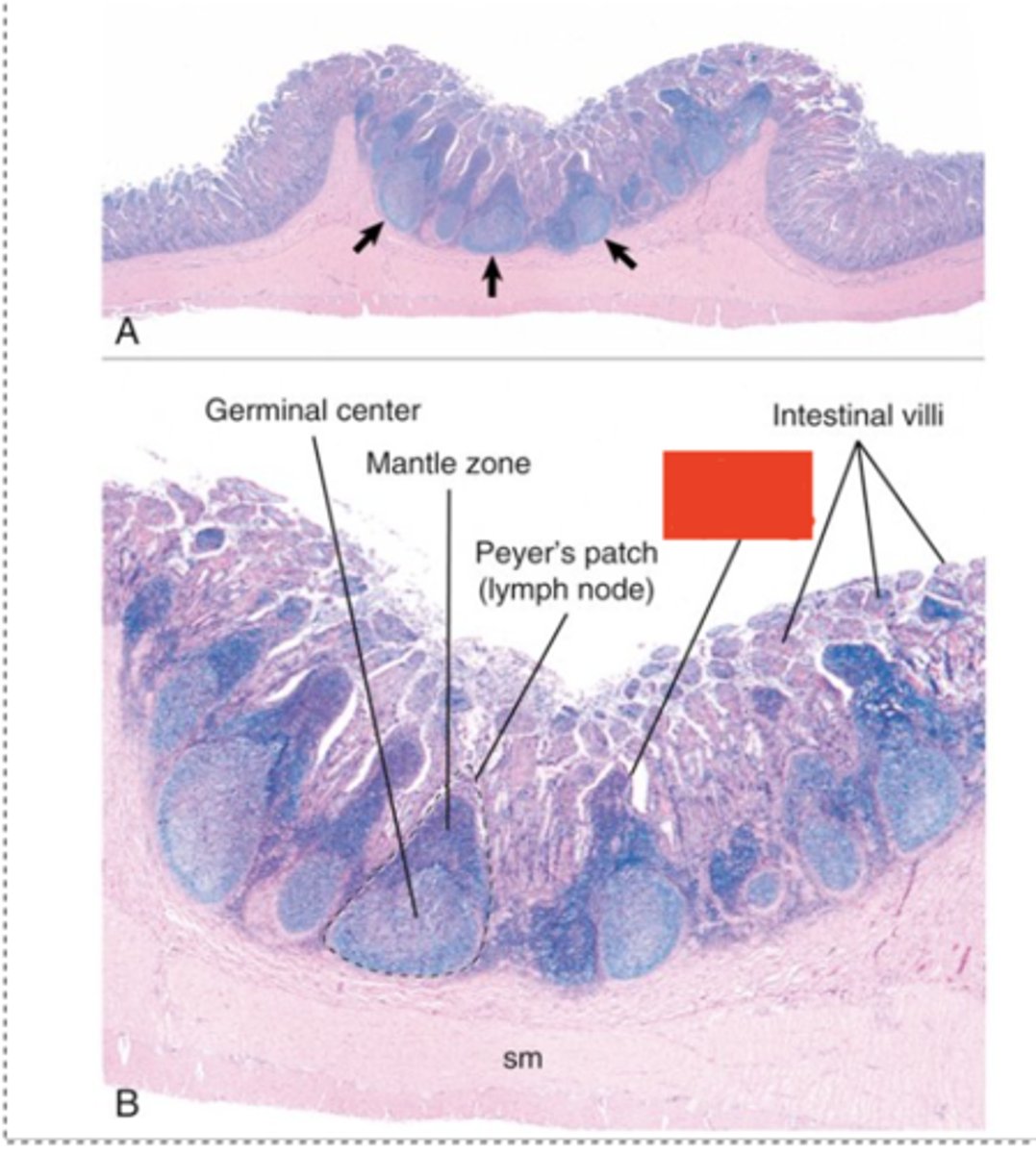 <p>What type of cell indicated by the red box functions to transfer antigens across the mucosa to dendritic cells and immune cells in the nodule ?</p>
