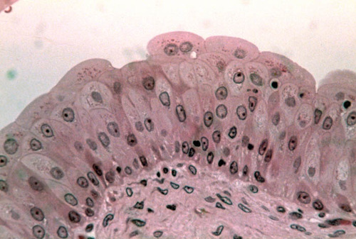 <p>-stretch to squamous shape (full) to cuboidal (empty)</p><ul><li><p>urinary bladder</p></li></ul>