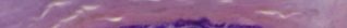 <p>Stratum lucidum</p>