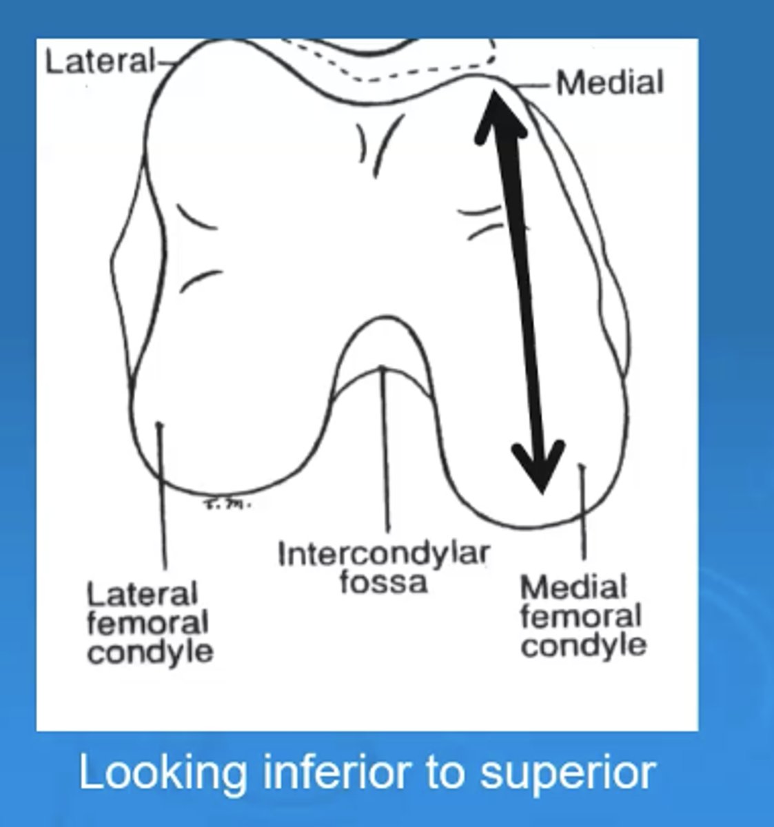 <p>medial is longer in anterior/posterior direction</p>