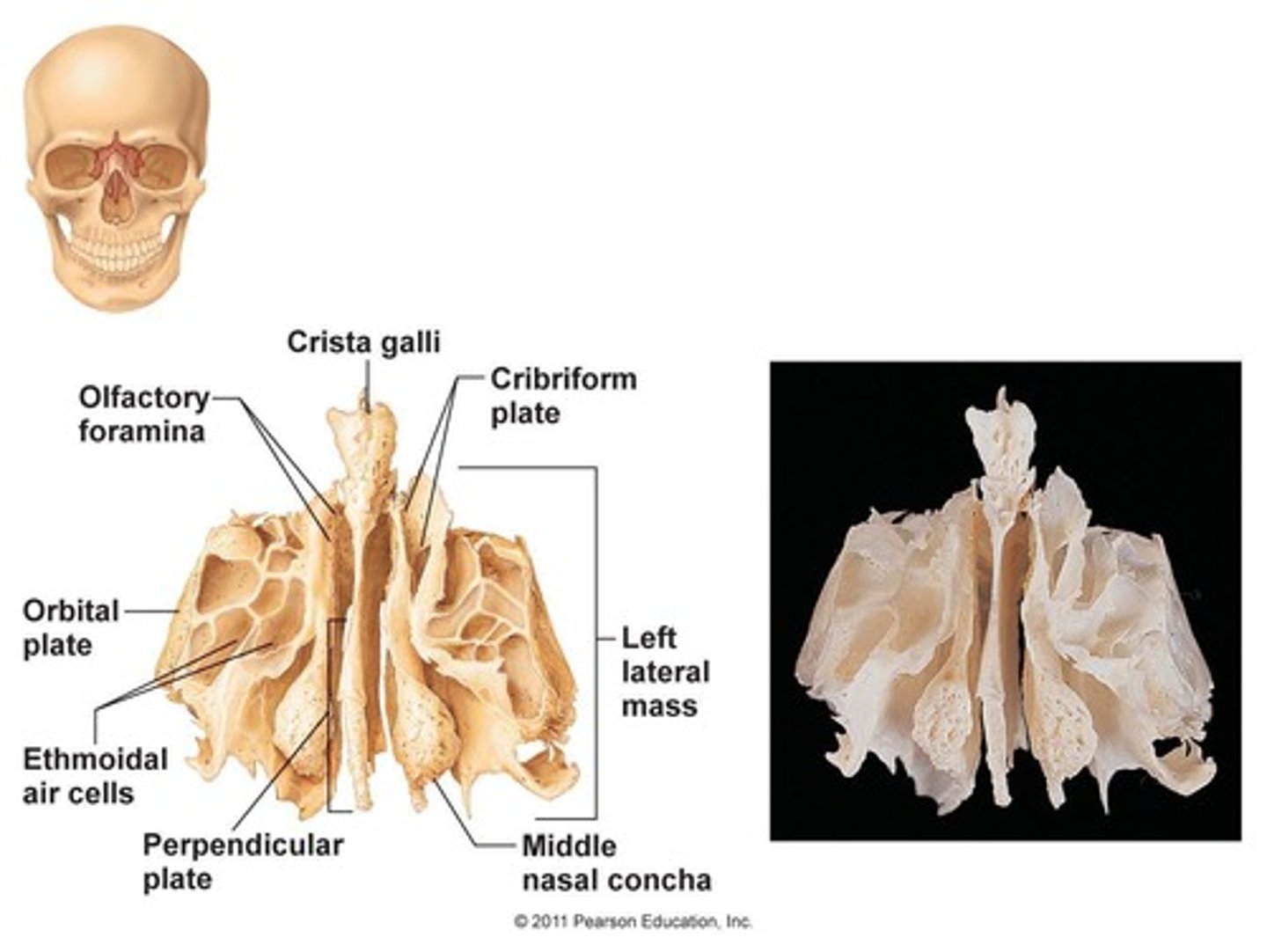 <p>surface features on bones</p>