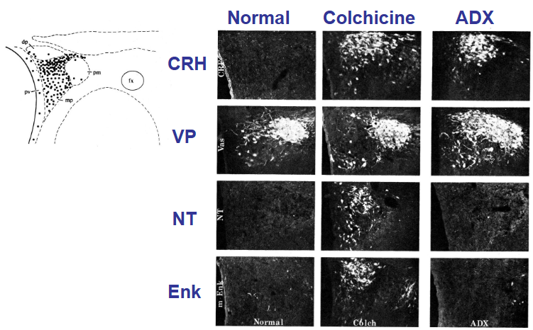 <p>Yes, but you must add Colchicine to visualize them (except VP) because they have high turn-over rates.</p><ul><li><p>ADX ONLY makes CRH visible (no cortisol = less negative feedback)</p></li><li><p>Colchicine depolarizes microtubules, which blocks axonal transport</p></li></ul><p></p>
