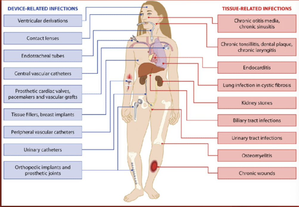 <ul><li><p>Catheter Associated Urinary Tract Infection (CAUTI)</p></li><li><p>Central Line Associated Blood Stream Infection (CLABSI)</p></li><li><p>Ventilator Associated Pneumonia (VAP)</p></li><li><p>Surgical Site Infection (SSI)</p></li><li><p>Clostridium Difficile Infection (CDI) </p></li></ul><p></p>