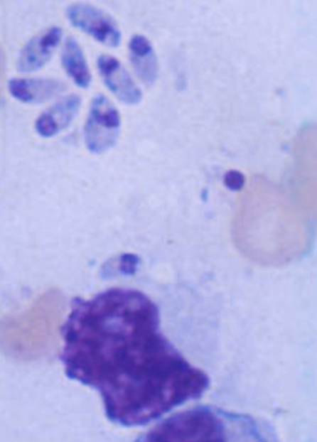 <p>What pathology is this and what parasite is it indicative of? </p>