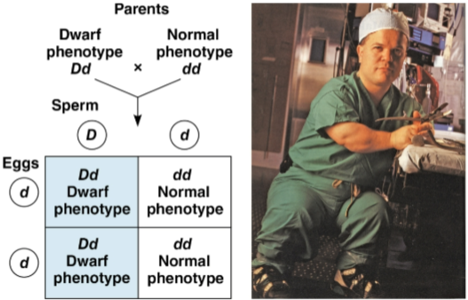 <p>Achondroplasia</p>