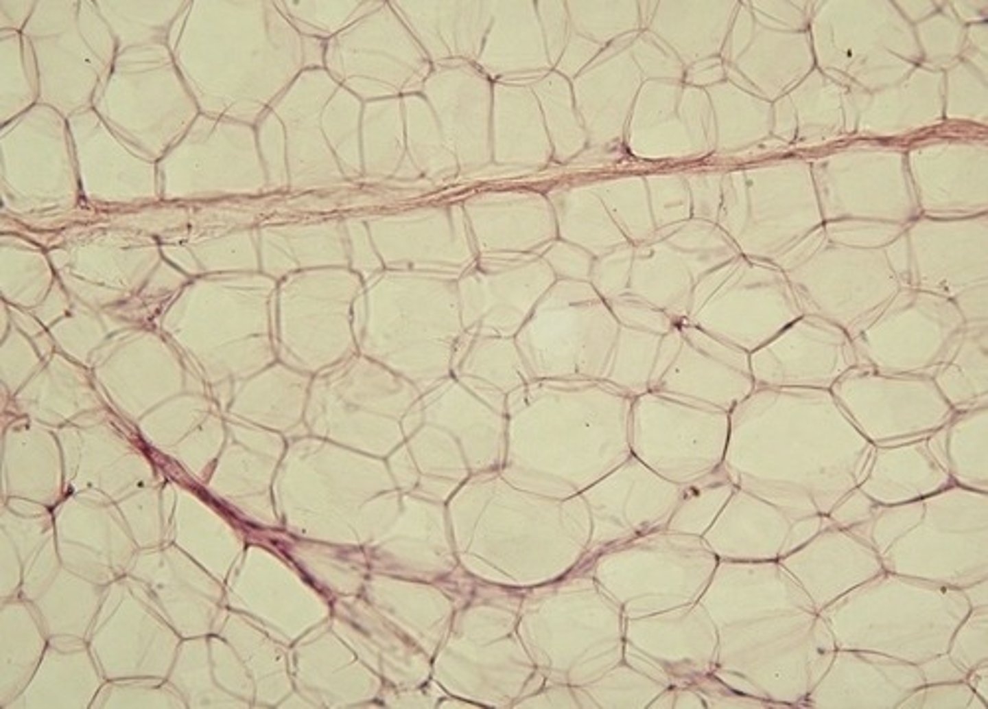 <p>Fat Cells</p>