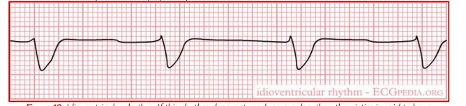<p>Idioventricular</p>