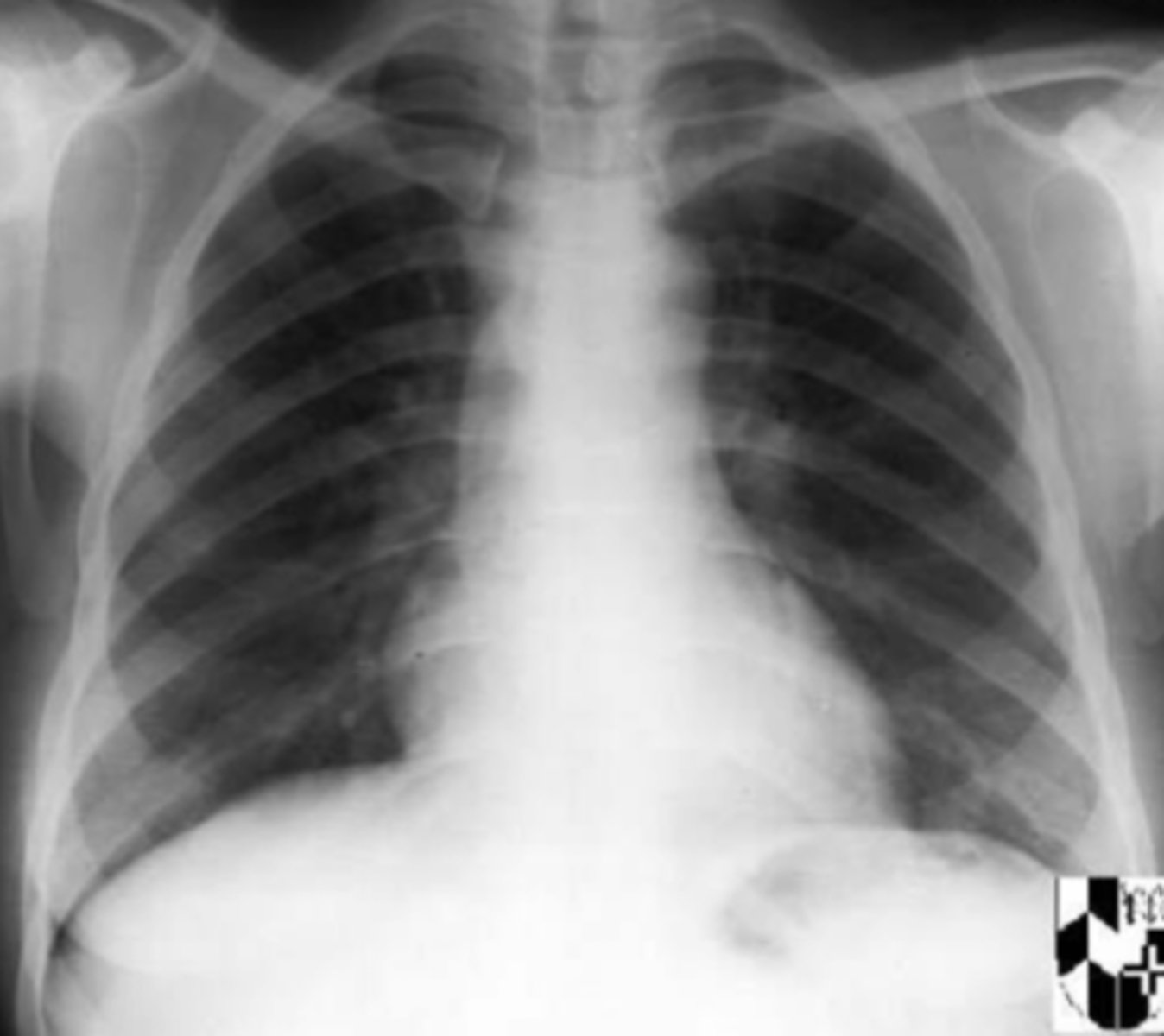 <p>What is the issue?</p>