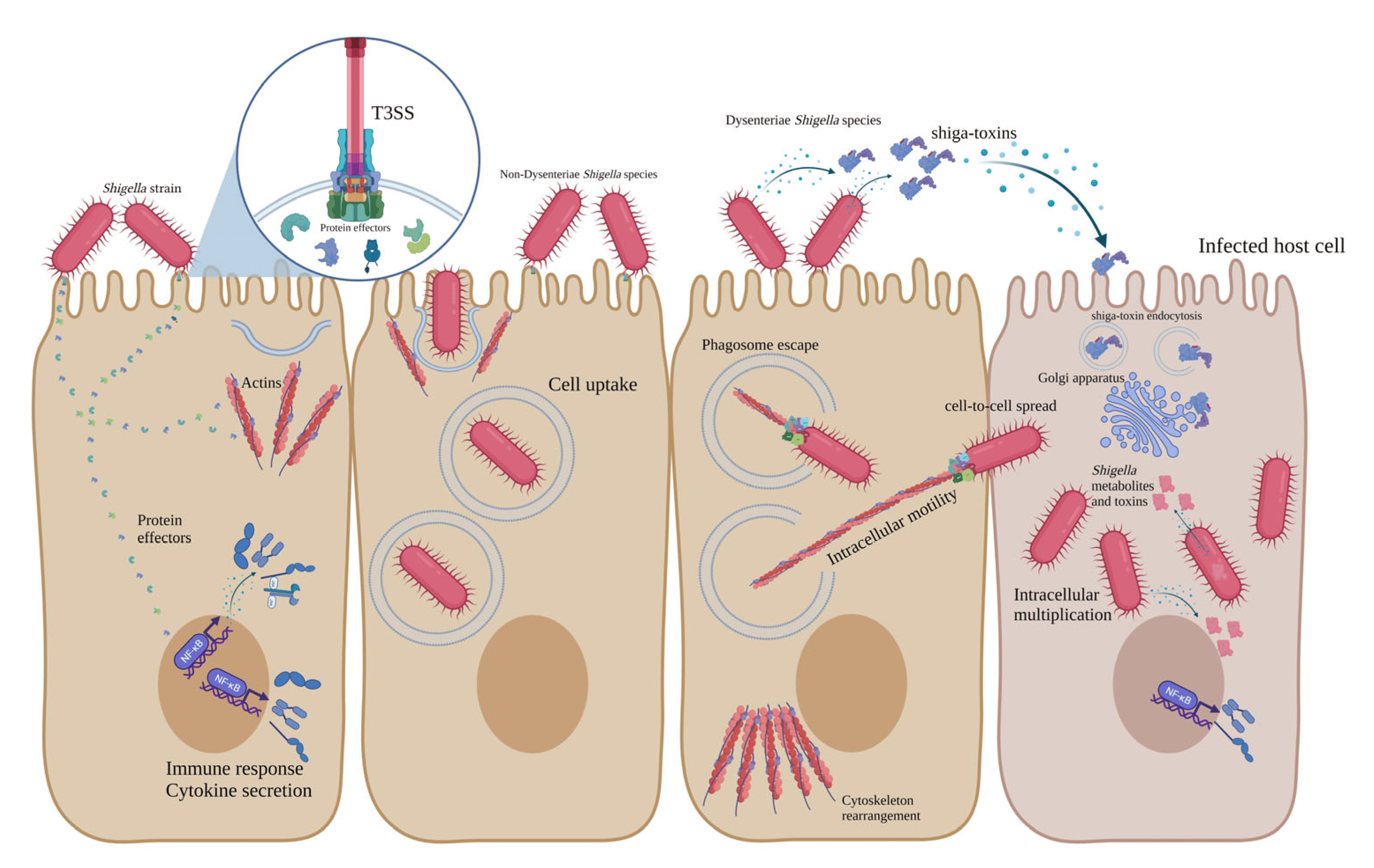 <ol><li><p><em>Shigella</em> binds to <strong>M cells</strong>, injecting bacterial proteins that disrupt the cytoskeleton, causing <strong>endocytosis</strong>.</p></li><li><p>Once inside, <em>Shigella</em> <strong>escapes the endosome</strong> and <strong>replicates in the cytoplasm</strong>.</p></li><li><p>Bacteria move <strong>cell-to-cell</strong> using <strong>actin tails</strong>, avoiding the bloodstream (no hematogenous spread).</p></li><li><p><em>Shigella</em> induces <strong>apoptosis</strong> in immune cells (<strong>macrophages</strong>), causing inflammation.</p></li><li><p>High levels of <strong>IL-1</strong> and <strong>PMN recruitment</strong> break down cell connections, leading to tissue damage.</p></li><li><p>The destruction of intestinal cells results in <strong>bloody diarrhea with mucus and PMNs (polymorphonuclear cells)</strong>.</p></li></ol><p></p>