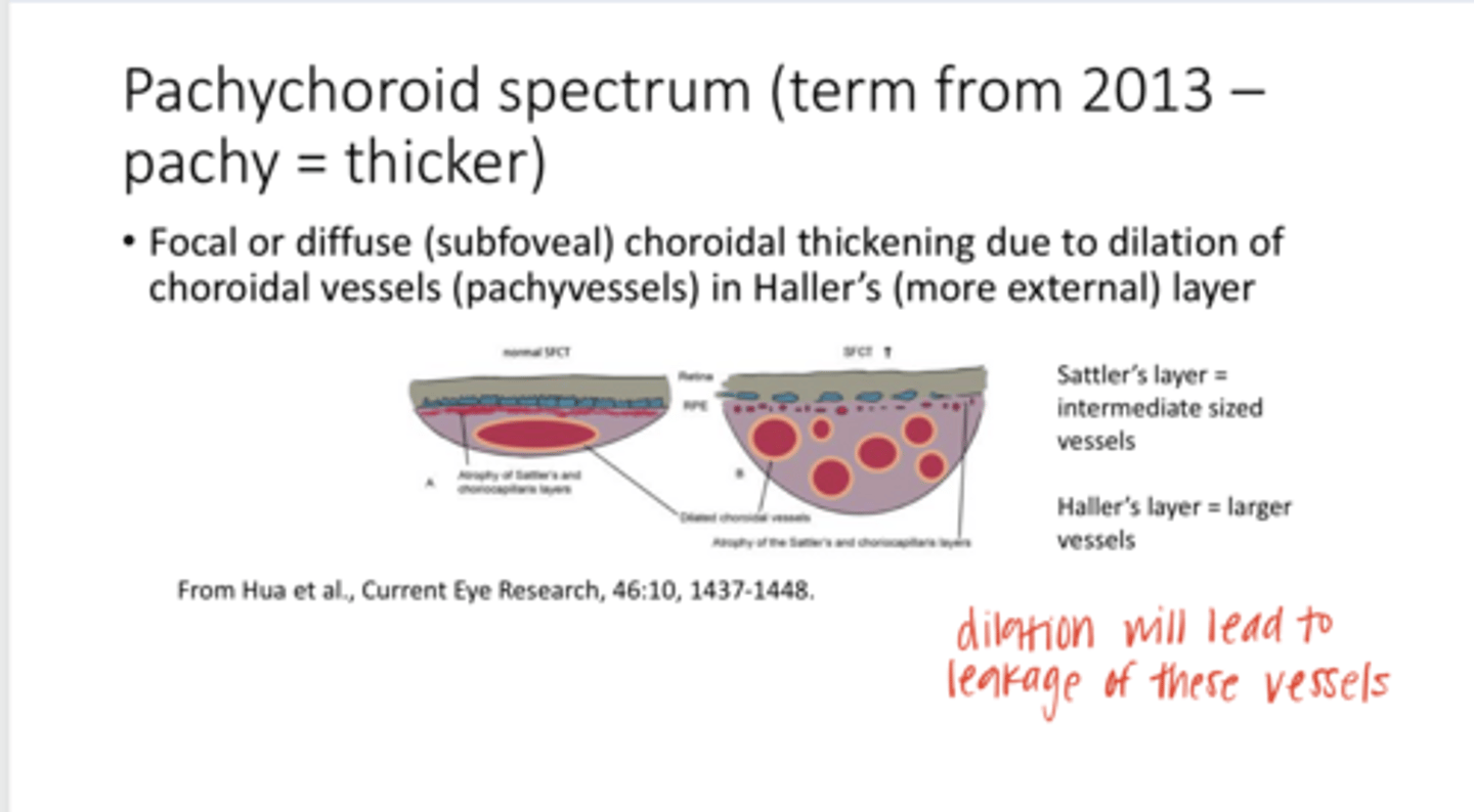 <p>What happens to the choroid in pachychoroidal disease?</p>