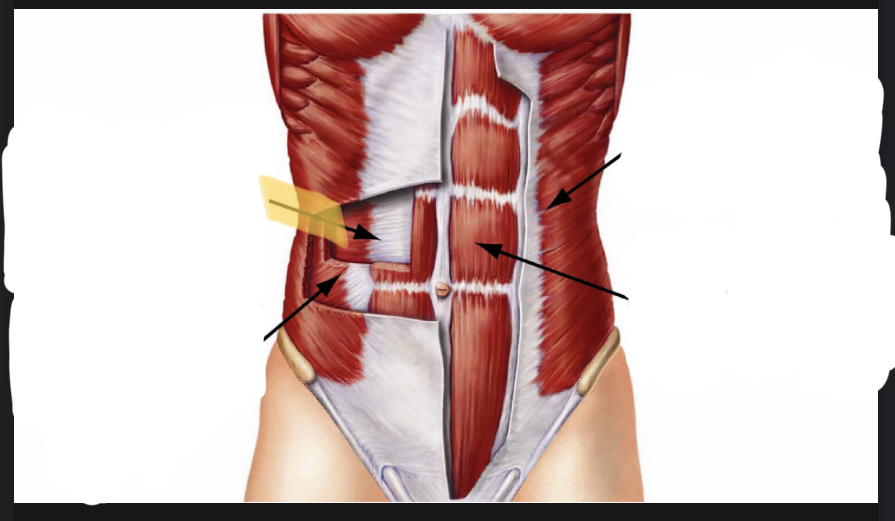 <p>Identify the highlighted muscle</p>