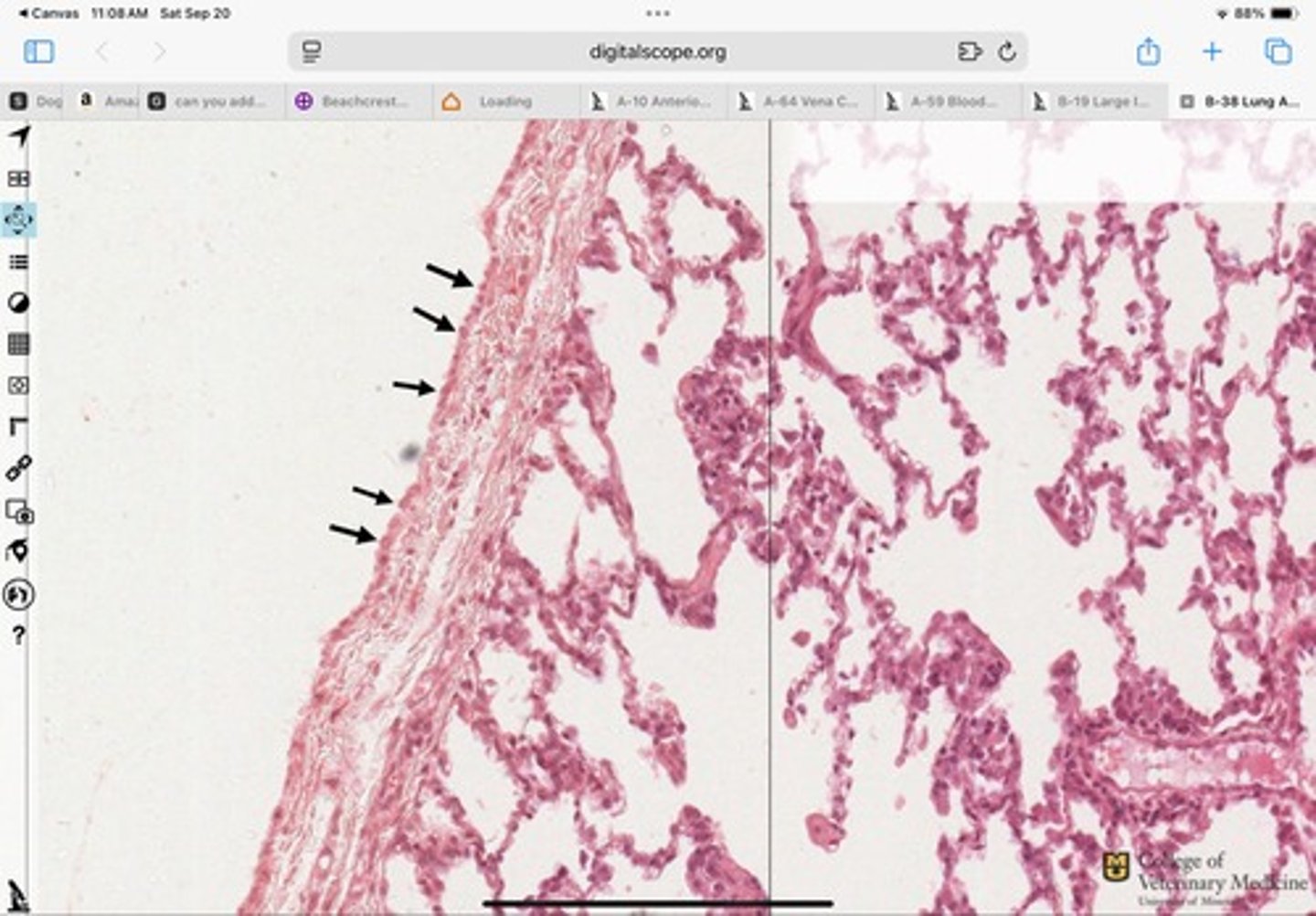 <p>What type of epithelium is shown?</p>