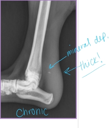 <p><span style="background-color: transparent;"><strong><span>Common Calcaneal Tendon Injury</span></strong></span></p>