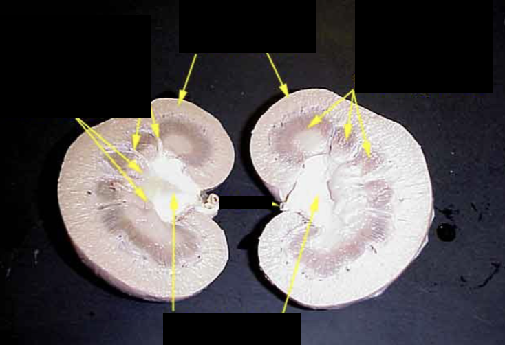 <p>label the dissection cut of a kidney.</p>