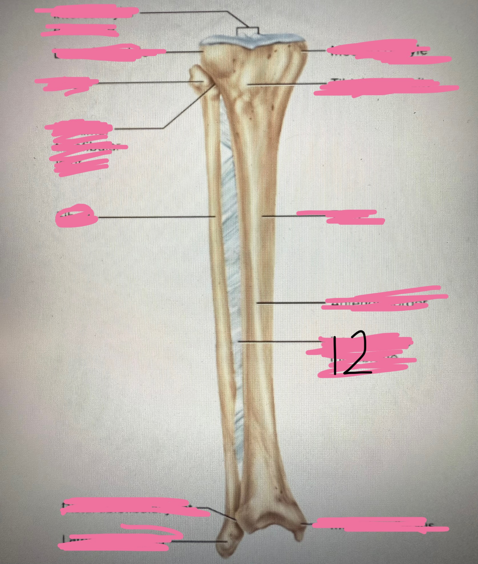 <p>12</p>