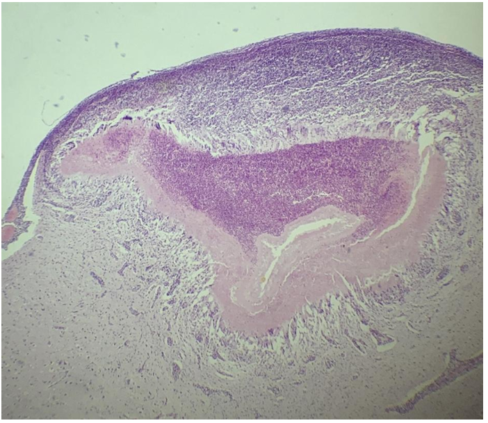 <p>this is?</p><img src="https://knowt-user-attachments.s3.amazonaws.com/bcdff5ac-1fca-44fb-9b44-ffd0306e33e1.png" data-width="50%" data-align="center"><p></p>