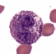 <p><strong>eosinophils</strong></p>