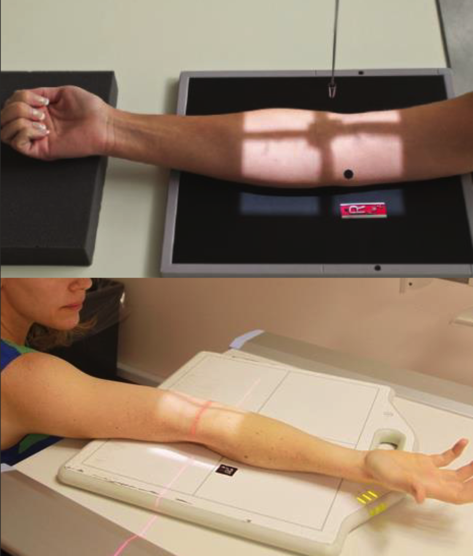 <ul><li><p>Long axis of elbow parallel to edge of IR.</p></li><li><p>Elbow in full extension and palm up → humeral epicondyles equidistant to IR.</p></li><li><p>Hand, elbow, and shoulder on same horizontal plane.</p></li><li><p>8-10cm of prox. forearm and distal humerus included.</p></li><li><p>Centre at cubital fossa.</p></li></ul><p></p>