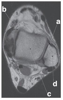 <p>Which letter is the talus?</p>