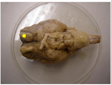 <p>Name the part of the brain marked by the yellow dot.</p>