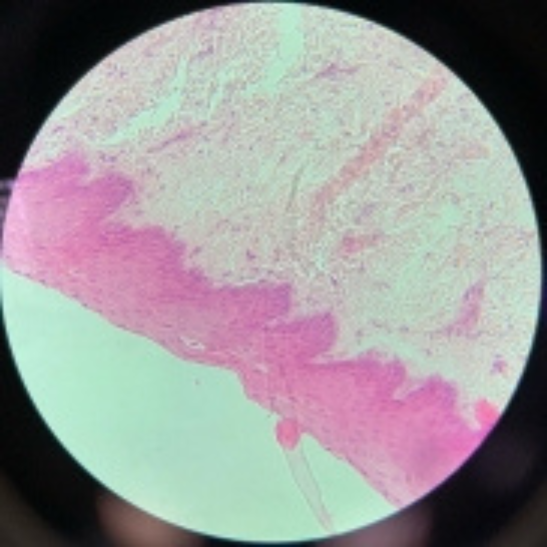 term image