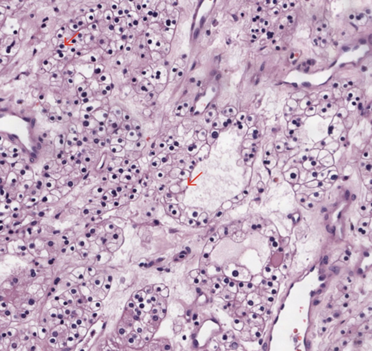 <p>Kidney</p>