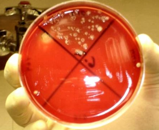 <p>1. e. coli (usually early infections)</p><p>2. f. necrophorum (more common 3-7 days post calving)</p><p>3. t. pyogenes (more chronic infections)</p><p>4. bacteroides</p>