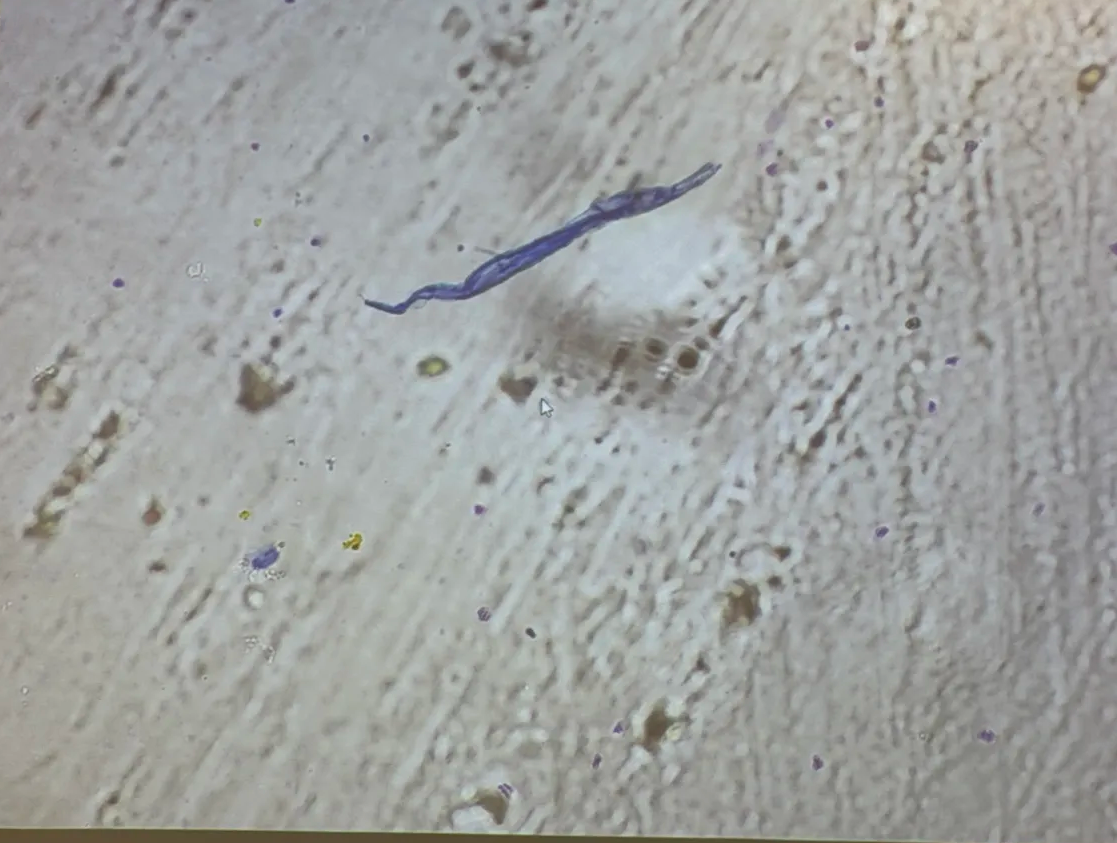 <p>in human Knott’s test</p>