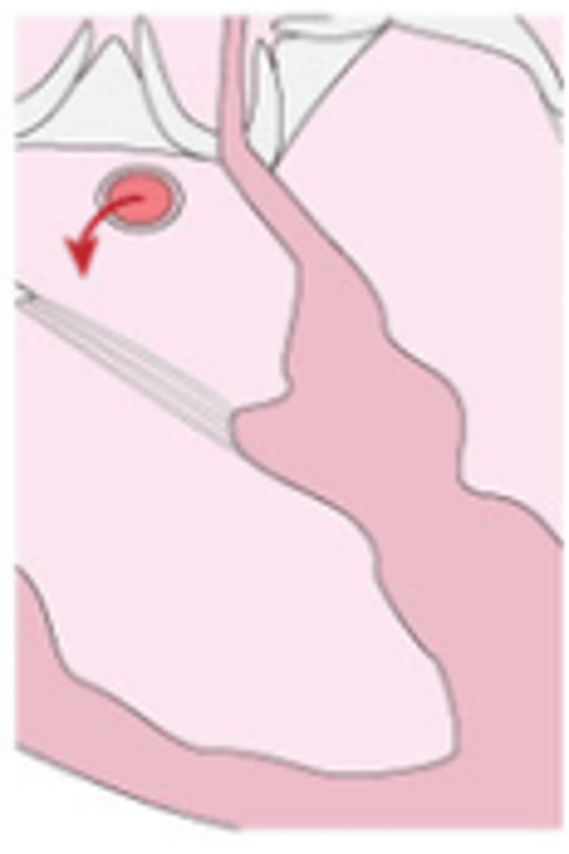 <p>found at structures where blood is entering the heart around the tricuspid and bicuspid valve (mitral).</p>