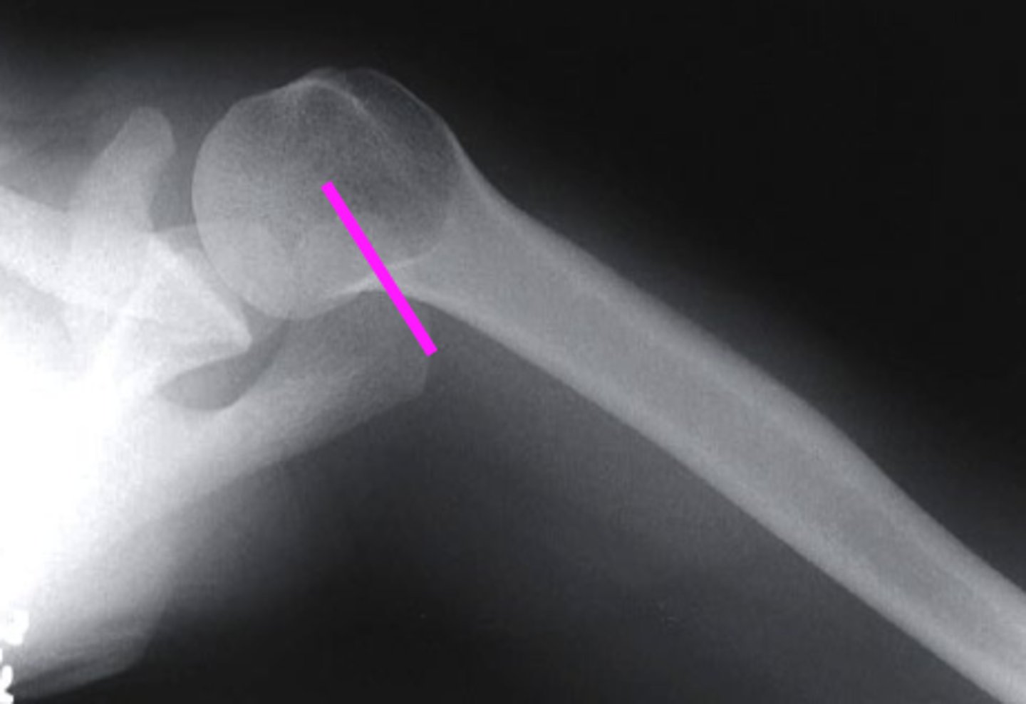 <p>what does the pink line point to?</p>