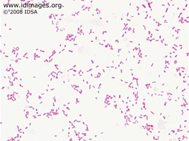 Klebsiella pneumoniae
