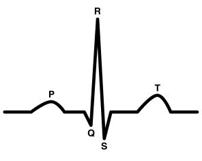 <p>Match the EKG Complex term with its respective definition:</p><p></p><ol><li><p>P wave</p></li><li><p>QRS Complex</p></li><li><p>T wave</p></li></ol><p></p><p>A. Atrial depolarization; leads to atrial contraction via the SA Node (*after isoelectric baseline)</p><p>B. Ventricular depolarization; leads to ventricular contraction; atrial repolarization also happens but is not visible</p><p>C. Ventricular Repolarization (rapid pulse)</p>