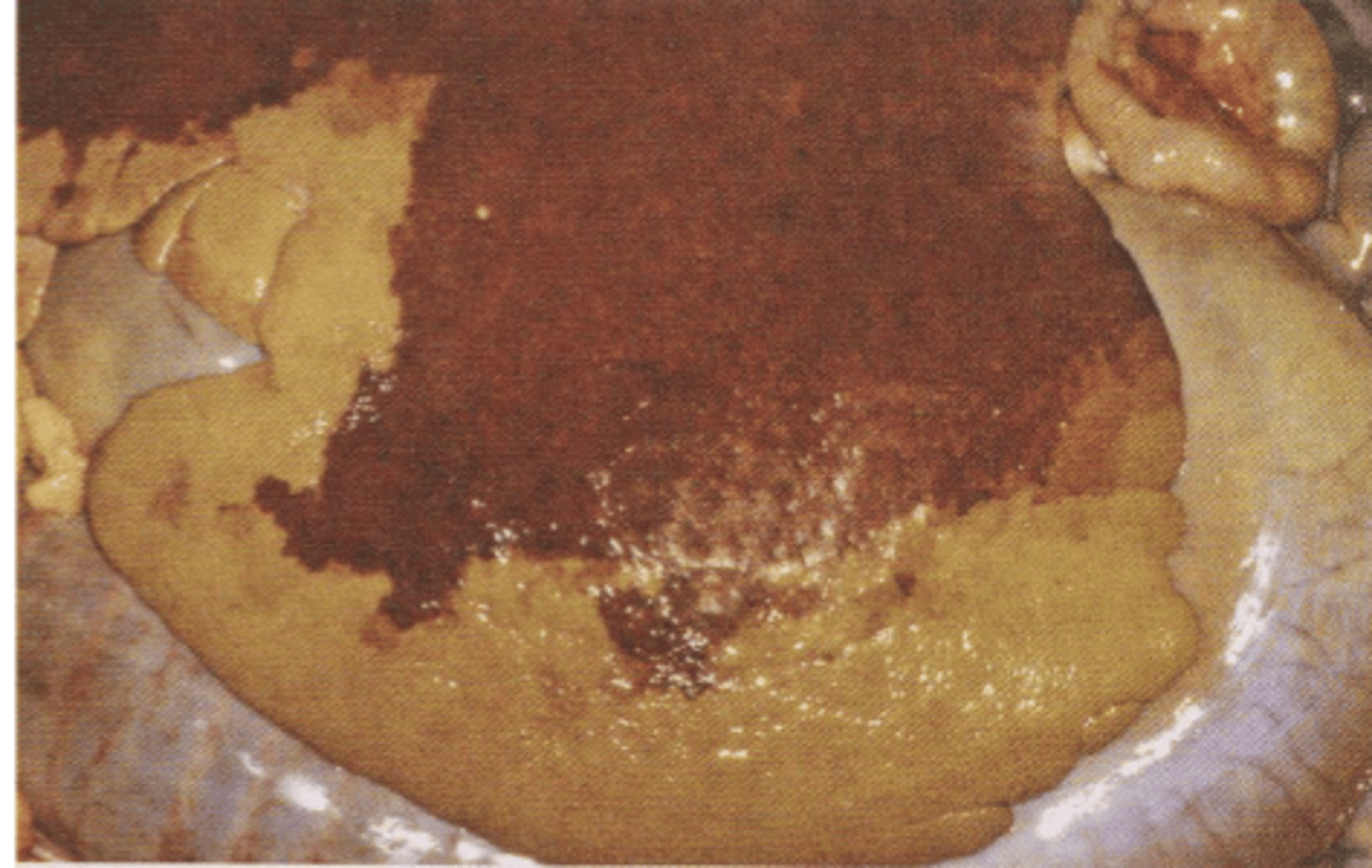 <p>1. Excessive accumulation of lipids in liver, occurs in pregnant and lactating animals (Animals with decreased feed intake but increasing energy needs). As well as any animal that stops eating</p><p>2. Loss of appetite, weight loss, weakness, recumbency</p><p>3. History, CS, blood test (increased liver enzymes + NEFA).</p><p>4. match energy and protein requirements to demands</p>