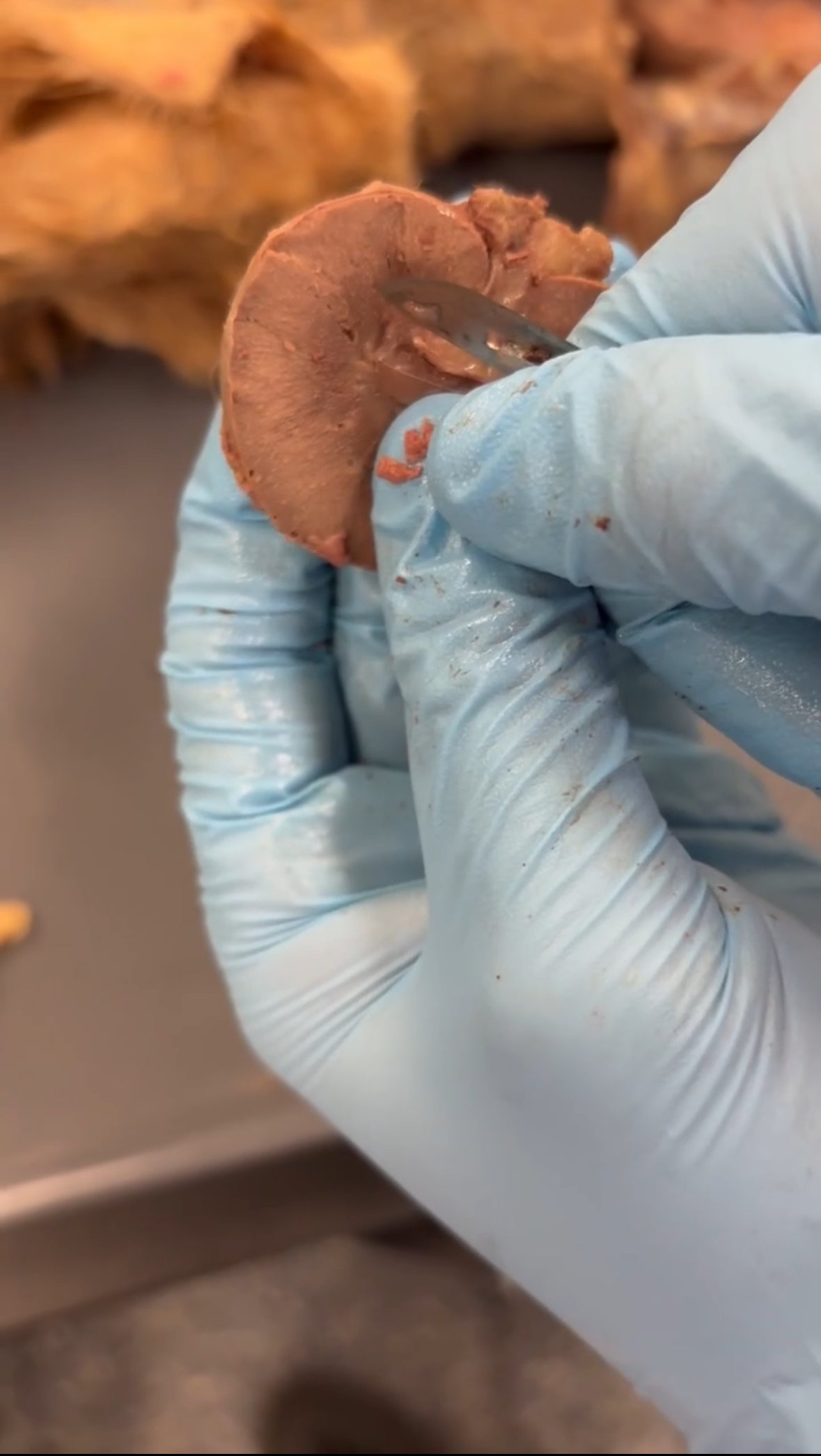 <p>Tip of Renal Pyramid</p>