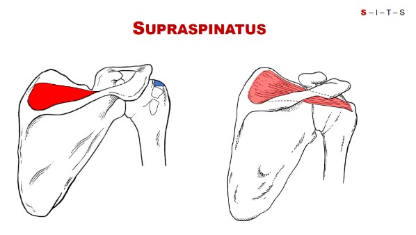 <p>Supraspinous fossa.</p>