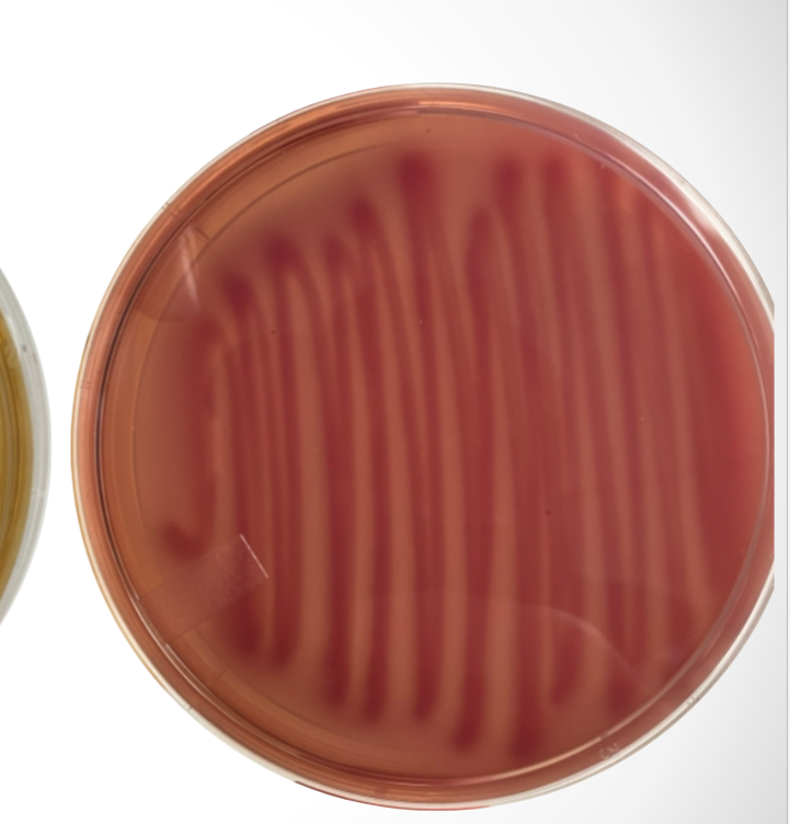 <p>What agar is used in this test? What bacteria was used and what does the reaction suggest?</p>