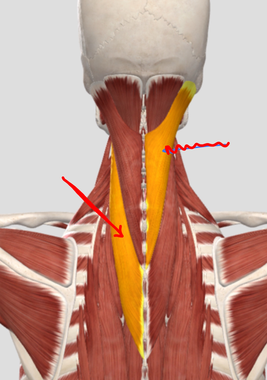 <p>What mm?</p><p>O, I, A bilateral and unilateral</p>