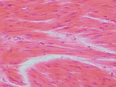 <p>muscle that’s spindle-shaped cells with central nuclei; no striations; cells arranged</p><p class="p1">closely to form sheets.</p>
