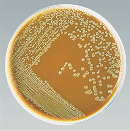 <p>It is <strong>Gram-negative, oxidase-positive, and catalase-positive</strong>, <strong>ferments <u>glucose</u></strong><u> </u>(but <strong>not lactose or maltose</strong>), and is cultured on <strong>chocolate agar, Thayer-Martin, or Martin-Lewis agar</strong> in a <strong>CO₂ environment</strong>.</p>